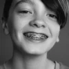 Why Do Some Kids Need Expanders Before Braces?