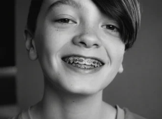 Why Do Some Kids Need Expanders Before Braces?