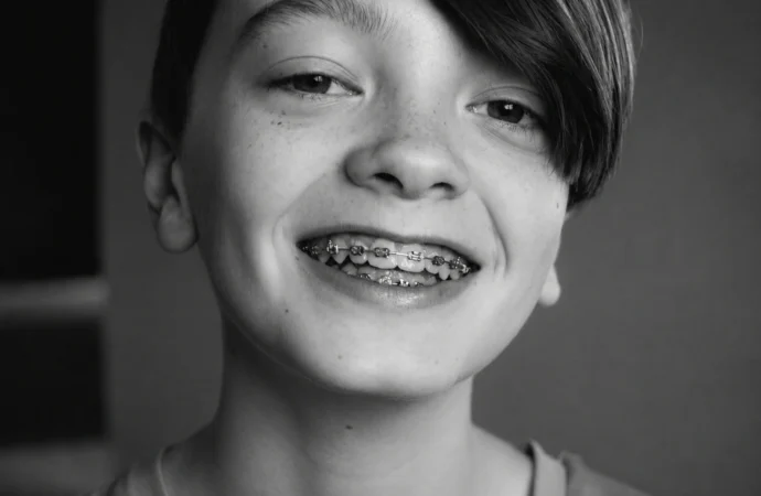 Why Do Some Kids Need Expanders Before Braces?