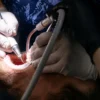 Why Do Patients Prefer Professional Dental Cleaning for Long-Term Oral Health?