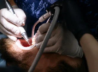 Why Do Patients Prefer Professional Dental Cleaning for Long-Term Oral Health?