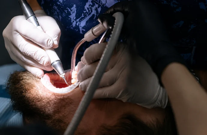 Why Do Patients Prefer Professional Dental Cleaning for Long-Term Oral Health?